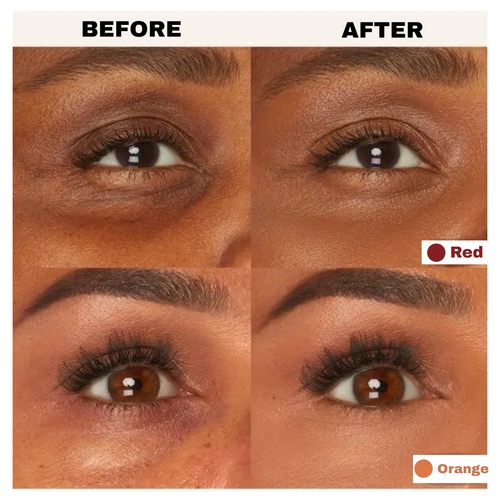 Elevelift Corrector 2.0