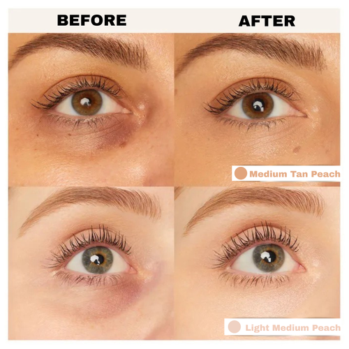 Elevelift Corrector 2.0